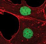 EVI1 Monoclonal Antibody (S.446.4)