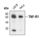 TNFR1 Monoclonal Antibody (B.34.10)