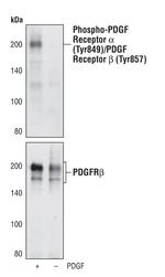 Phospho-PDGFRA/PDGFRB (Tyr849, Tyr857) Monoclonal Antibody (T.564.8)