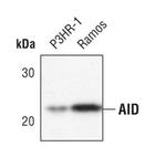 AID Monoclonal Antibody (K.15.2)
