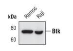 Btk Monoclonal Antibody (E.127.9)