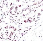 H3K4me3 Antibody in Immunohistochemistry (IHC)