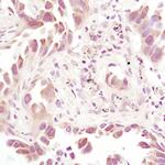 Thioredoxin 1 Monoclonal Antibody (H.753.8)