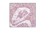 PPP2R1A Antibody in Immunohistochemistry (Paraffin) (IHC (P))
