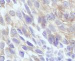 beta Tubulin Antibody in Immunohistochemistry (IHC)