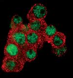 EGR1 Monoclonal Antibody (T.160.5)