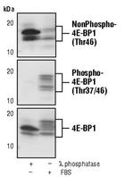 Nonphospho-4EBP1 (Thr46) Monoclonal Antibody (E.638.3)