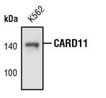CARD11 Monoclonal Antibody (B.472.3)