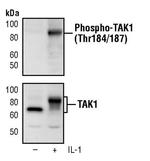 Phospho-TAK1 (Thr184, Thr187) Monoclonal Antibody (K.846.3)