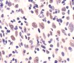 MRE11 Monoclonal Antibody (F.519.4)