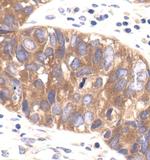 AMPK beta-1,2 Monoclonal Antibody (E.427.6)