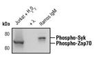 Phospho-ZAP70/Syk (Tyr319, Tyr352) Monoclonal Antibody (R.658.6)