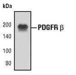 PDGFRB Monoclonal Antibody (K.596.7)