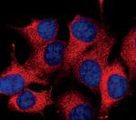 IkB alpha Monoclonal Antibody (T.937.7)