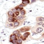 IkB alpha Antibody in Immunohistochemistry (Paraffin) (IHC (P))
