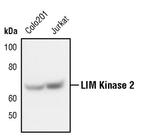 LIMK2 Monoclonal Antibody (T.756.1)