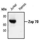 Zap-70 Monoclonal Antibody (C.459.2)