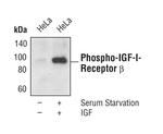Phospho-IR/IGF1R beta (Tyr1135, Tyr1136, Tyr1150, Tyr1151) Recombinant Rabbit Monoclonal Antibody (S.326.5)