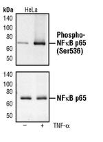 Phospho-NFkB p65 (Ser536) Antibody