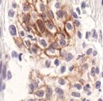 Phospho-ErbB3 (Tyr1289) Monoclonal Antibody (E.350.3)