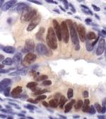 Phospho-ERK1/ERK2 (Thr202, Tyr204) Monoclonal Antibody (S.812.9)