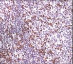 Zap-70 Antibody in Immunohistochemistry (Paraffin) (IHC (P))