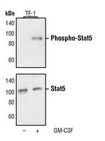 Phospho-STAT5 alpha (Tyr694) Monoclonal Antibody (B.776.8)