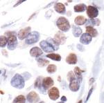 Phospho-Estrogen Receptor alpha (Ser118) Antibody in Immunohistochemistry (Paraffin) (IHC (P))