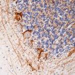 Neurofilaments 70/200 kDa Antibody in Immunohistochemistry (Paraffin) (IHC (P))