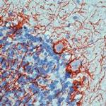 Neurofilaments 70/200 kDa Antibody in Immunohistochemistry (Paraffin) (IHC (P))