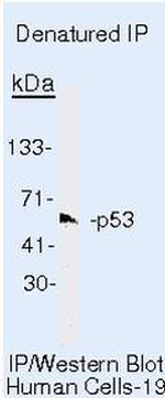 p53 Antibody in Immunoprecipitation (IP)