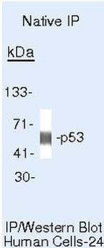 p53 Antibody in Immunoprecipitation (IP)