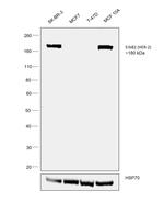 ErbB2 (HER-2) Antibody in Western Blot (WB)