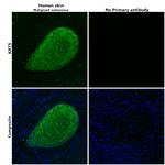 Cytokeratin 5 Antibody in Immunohistochemistry (Paraffin) (IHC (P))
