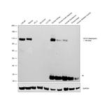 CD10 Antibody in Western Blot (WB)