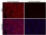 PTEN Antibody in Immunohistochemistry (Paraffin) (IHC (P))