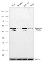 Metadherin Antibody in Western Blot (WB)