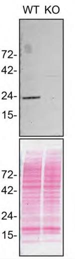RAB10 Antibody in Western Blot (WB)