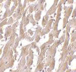 MyD88 Monoclonal Antibody (2E9C2)