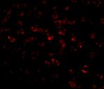 Bim Antibody in Immunocytochemistry (ICC/IF)