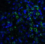 MD-2 Monoclonal Antibody (1A2E3)
