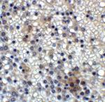 MD-2 Antibody in Immunohistochemistry (IHC)