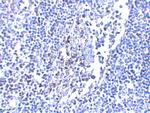 IL-33 Antibody in Immunohistochemistry (IHC)