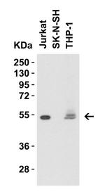 CD4 Antibody in Western Blot (WB)