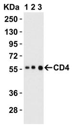 CD4 Antibody in Western Blot (WB)