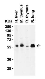 CD4 Antibody in Western Blot (WB)