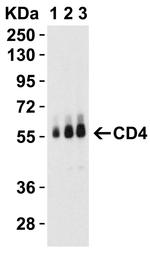 CD4 Antibody in Western Blot (WB)