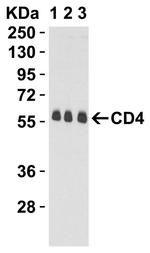 CD4 Antibody in Western Blot (WB)