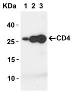 CD4 Antibody in Western Blot (WB)