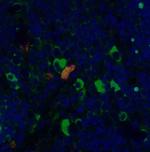 CD4 Antibody in Immunohistochemistry (PFA fixed) (IHC (PFA))